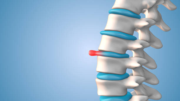 Soluções para Dor Lombar em Atibaia – Fisioterapia Especializada
